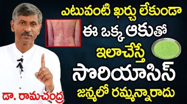 ఈ ఆకులతో ఇలాచేస్తే సోరియాసిస్ మటుమాయం | Psoriasis Treatment | in Telugu | Dr Ramachandra | PlayEven 14 1681691066 maxresdefault
