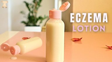 Homemade Eczema Lotion 10 1681696007 maxresdefault