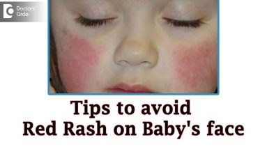 Baby cheeks red and dry in winter |Causes & Remedies - Dr. Rashmi Ravindra | Doctors' Circle 12 1681699830 maxresdefault