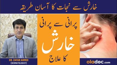 Kharish Khatam Karne Ka Tarika - Scabies Ka Ilaj In Urdu - Itching Treatment - Kharish Ka Fori Ilaj 8 1681702091 maxresdefault