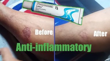 1681704544 hqdefault