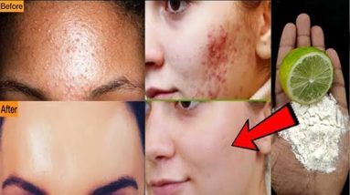 1681705320 maxresdefault