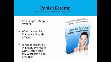 Vanish Eczema Review | How Do You Get Rid Of Eczema 2 1681713066 maxresdefault