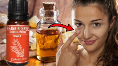 Frankincense Oil Uses & Benefits For Healing The Body 20 1681753517 maxresdefault