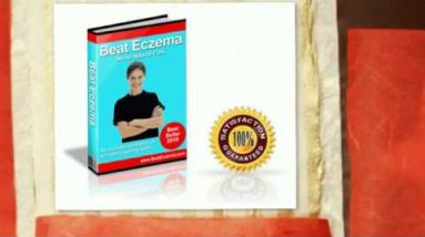 Cure Finger Eczema Tip 16 1681760917 hqdefault
