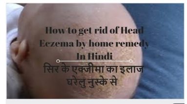 How to get rid of Head Eczema In Hindi 14 1681764589 hqdefault
