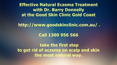 A Gold Coast Dermatoligist DR Barry Donnelly Successfully Treats Eczema the Natural Way 6 1681779468 maxresdefault