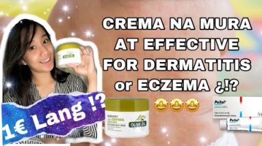 1 Euro Cream to Cure Eczema or Dermatitis 14 1681799298 hqdefault