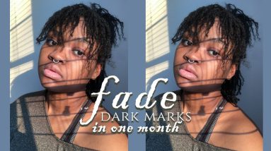 Skincare Routine 2021 | Fade Dark Marks FAST One Month | Eczema 2 1681821358 maxresdefault