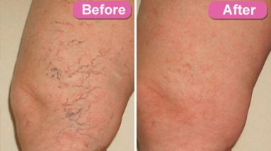 1681848714 maxresdefault