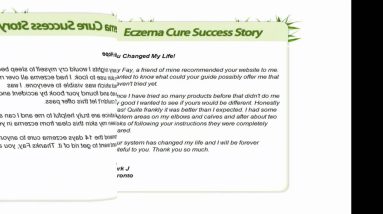 Eczema Natural Treatment - Natural Way To Cure Eczema.mp4 20 1681864304 maxresdefault