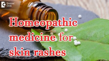 Homeopathic medicine for skin rashes - Dr. Surekha Tiwari 16 1681871603 maxresdefault