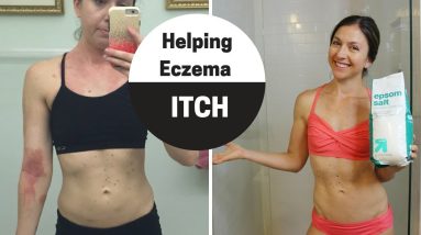 How to stop itchy eczema skin - sharing my secret process 14 1681875285 maxresdefault