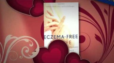 3 Best Over the Counter Eczema Cream 10 1681880101 hqdefault