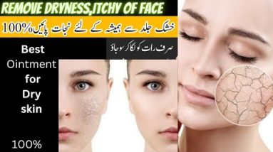 BEST CREAM/OINTMENT FOR DRY SKIN | GET SOFT smooth skin Instantly|Remove Itchyness ,Dryness | 4 1681928168 hqdefault