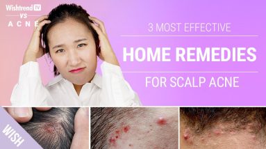 1681959797 maxresdefault