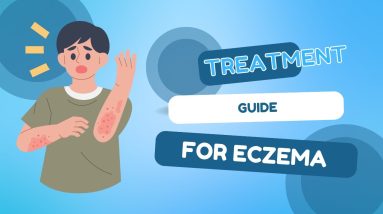How to Treat Eczema 6 1681961738 maxresdefault