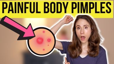 1681992876 maxresdefault