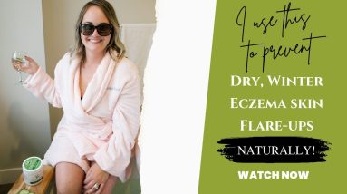Natural Winter Eczema Relief 20 1682046478 maxresdefault