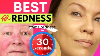 This GETS RID OF REDNESS...in 30 SECONDS!!! ROSACEA, ECZEMA, SENSITIVE SKIN & MELASMA! 18 1682050271 maxresdefault