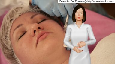 Treating Eczema Without Steroids 18 1682052428 maxresdefault