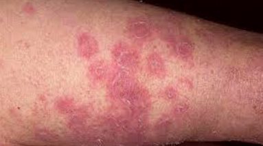 1682062875 maxresdefault