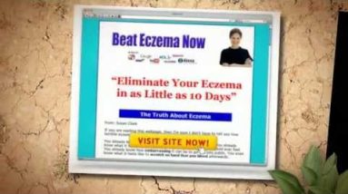 Eczema Treatment Over The Counter : 3 Highly Effective Treatment Get Rid Eczema 12 1682063475 hqdefault