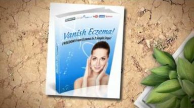 Herbs For Eczema On Back -- Fight Back Against Your Eczema Using Natural Methods 8 1682070865 hqdefault