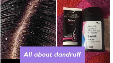 Dandruff Reasons and Treatment | Seborrheic Dermatitis | Nidhi Chaudhary 10 1682104102 maxresdefault