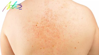 ✅Arturo Millennium Grass Ointment Cream Natural Chinese Herb Herbal Medicine Psoriasis Eczema 8 1682105508 maxresdefault