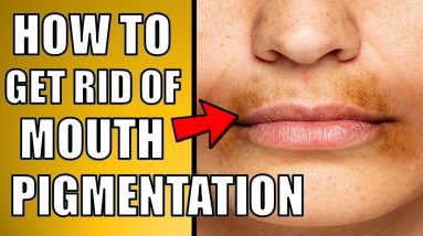 How to Get Rid of Pigmentation Around Mouth Naturally 6 1682111415 maxresdefault