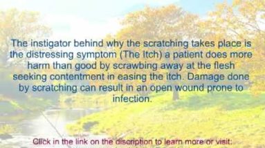 Eczema symptoms - eczema skin symptoms 6 1682117851 hqdefault