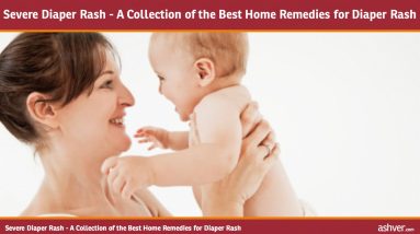 Severe Diaper Rash - A Collection of the Best Home Remedies for Diaper Rash 2 1682119915 maxresdefault