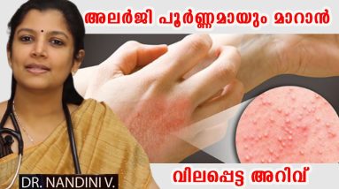 അലർജി പൂർണ്ണമായും മാറാൻ ഇതിലും നല്ല മാർഗം വേറെയില്ല /Baiju's Vlogs 20 1682123587 maxresdefault