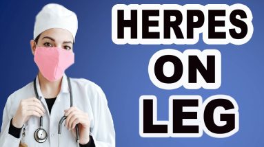 Herpes On Leg 8 1682145784 maxresdefault
