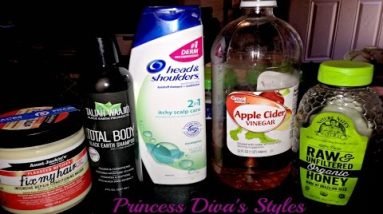 Diva's Scalp Eczema Flare Up Remedy | Little Girls | 4A Hair 14 1682153401 hqdefault