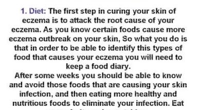 How To Get Rid Of Eczema-5 Surefire Remedies That Works! 20 1682166127 hqdefault