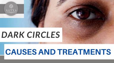 1682181603 maxresdefault