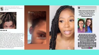 Bea's Bayou Skincare Customer Reviews | Help Relieve Dandruff and Scaly Scalp & Skin Itch 16 1682186467 maxresdefault