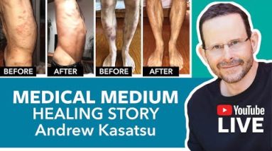 Medical Medium Healing Story Andrew Kusatsu⎜SEASON 1 Episode #10 18 1682206497 hqdefault