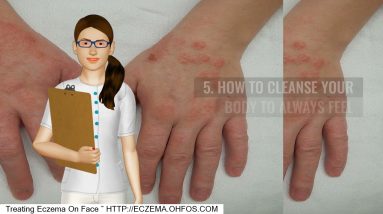 Excimer Laser Treatment For Eczema 14 1682213852 maxresdefault