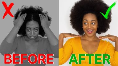 DRY, ITCHY SCALP? Cure it FAST | 4C Natural Hair 20 1682216242 maxresdefault