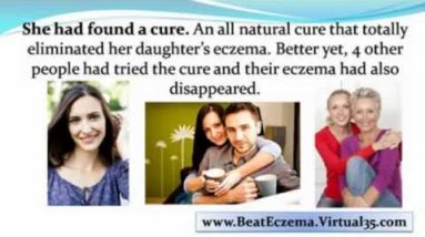 hand eczema treatment - eczema home treatment - eczema treatment 12 1682217600 hqdefault