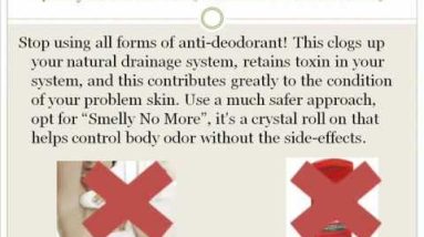 How To Get Rid of Eczema Naturally 10 1682221314 hqdefault