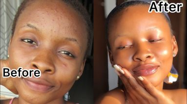 How I Truly Got Rid Of My Pimples In 2 Weeks | Clear Skin | 16 1682223896 maxresdefault