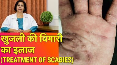 1682226064 maxresdefault