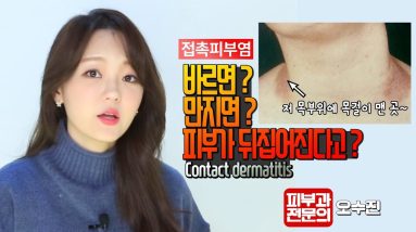(*Eng) 접촉피부염의 모든 것, (allergic/irritant) contact dermatitis - 피부과전문의 (dermatologist) 오수진 12 1682231512 maxresdefault