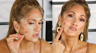 HOW TO COVER + HEAL SCABS | BURNS | BLEMISHES 6 1682242543 maxresdefault