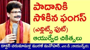 Athletes Foot (Fungus), Causes and Ayurvedic Treatment in Telugu by Dr. Murali Manohar, M.D. 4 1682246198 hqdefault