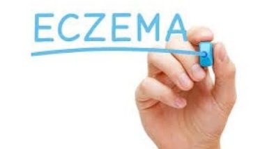 How I Cured My Eczema Naturally 20 1682251083 hqdefault